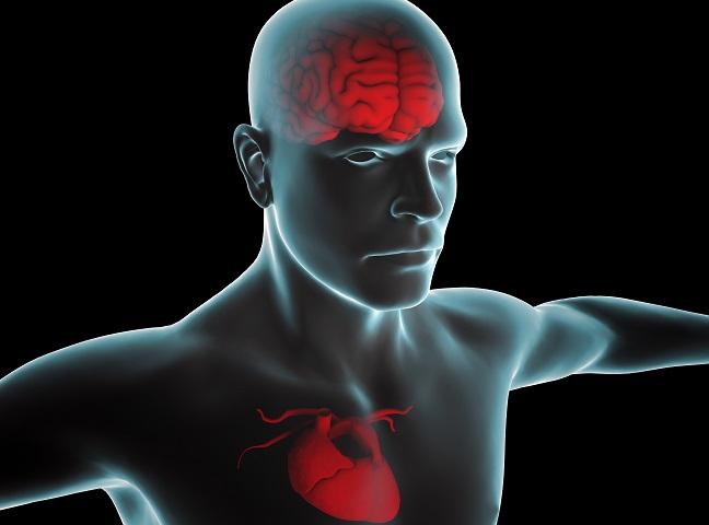 Neurological Prognosis Affects Survival Benefit of Early Intervention After Cardiac Arrest