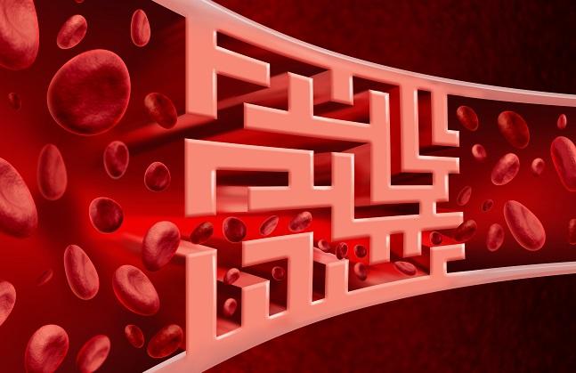 Ticagrelor: Better Platelet Blockade Post-TAVR?