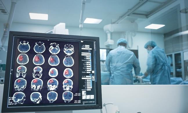 Benchmarks for Endovascular Stroke Therapy Get Their First Update in 5 Years