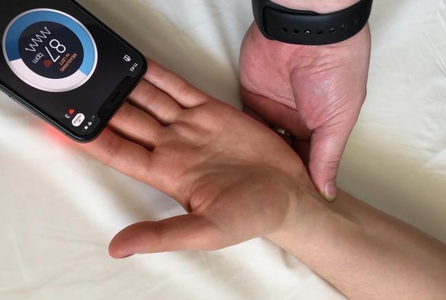 Smartphone Heart Rate-Monitoring App Can Accurately Assess Radial Artery Patency 