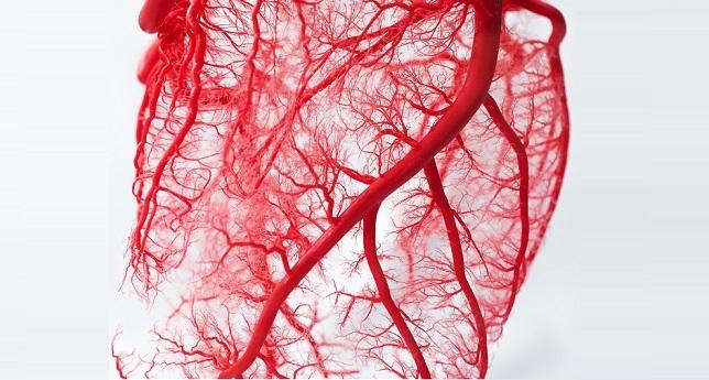 STEMI Patients With Persistent Ischemia After PCI: A Potential Target for IABP?