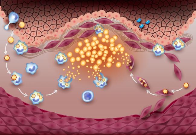 Serial CTA Shines a Light on Statin Effects in Subclinical CAD