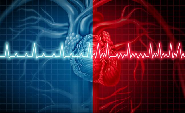 Ischemic Stroke Risk Scoring May Not Be Accurate for Patients With Atrial Flutter