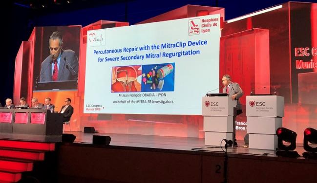 MITRA-FR: No Benefit of MitraClip in Functional MR