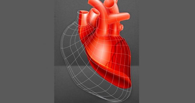 Cell Therapy No Help for Cardiac Recovery in HF Patients With LVADs