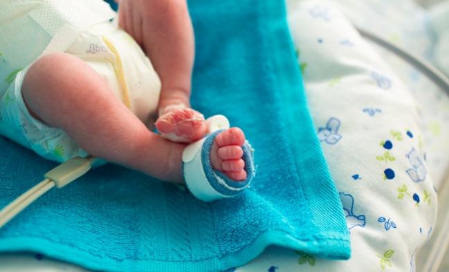 FDA Approves Pea-Sized Occluder for Patent Ductus Arteriosus in Premature Babies