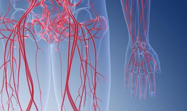 Eluvia Sustains Lead Over Zilver PTX in Patients With Diabetes: IMPERIAL Subanalysis