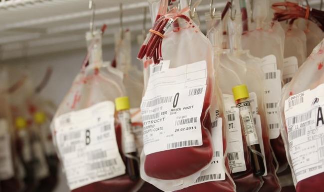 Blood Conservation Strategy Reduces Need for Transfusion Following Cardiac Surgery