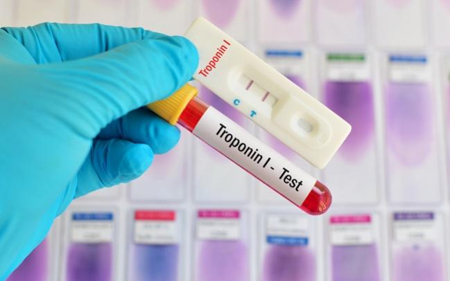 None of the Usual Suspects? Troponin Elevation Still Warrants Attention