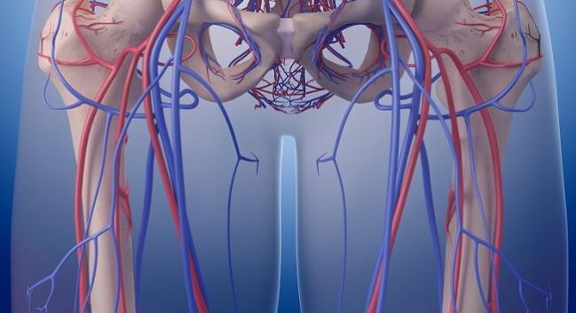 Vici Venous Stent Shows Good Primary Patency, Few MAE by 12 Months: VIRTUS