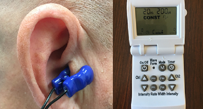  GoLiveAi Vagus Nerve Stimulator with Ear Clip : Vagus