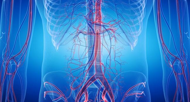 OVER Trial: Long-term Mortality Similar After Endovascular and Open AAA Repair