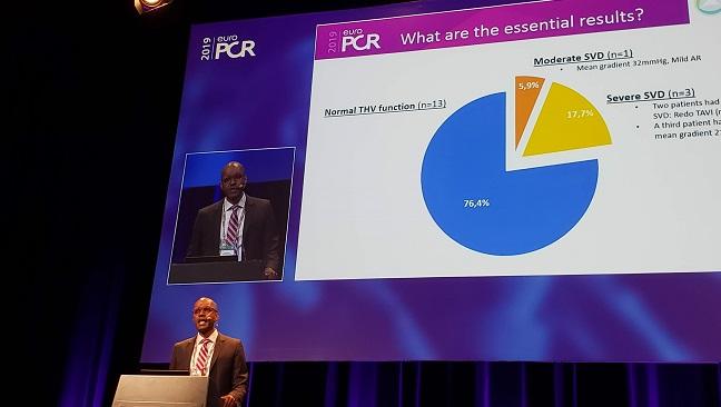 TAVR Durability ‘Snapshot’ Offers Some Reassurances 8 to 10 Years Out