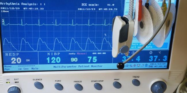 Longer Follow-up ‘Reassuring’ for New-Onset LBBB After TAVR—With Caveats 