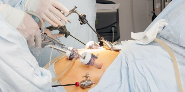 Bariatric Surgery Linked to Survival Advantage After MI and CVA