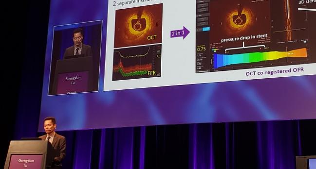 Early Days With OCT-Derived FFR Technology, but New Data Suggest Promise 