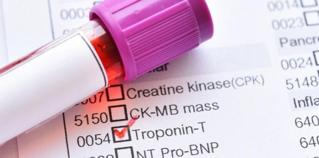 Tool May Ease Use of High-Sensitivity Troponin for Acute MI Diagnosis