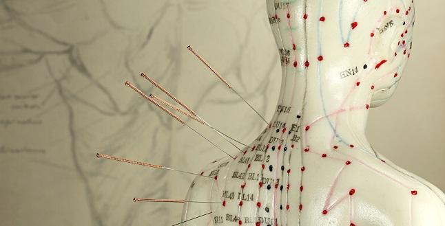 Acupuncture for Angina? Chinese Study Backs Targeted Approach