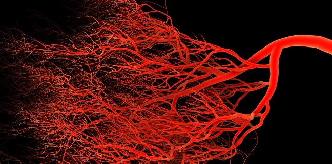 Microvascular Disease Quadruples Risk of Leg Amputation 