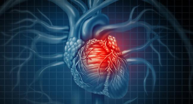 New ‘Chronic Coronary Syndrome’ Guidelines Stress There’s Nothing Stable About CAD 
