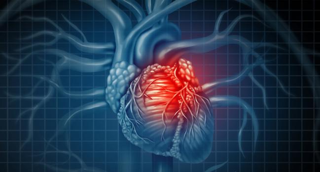 New ‘Chronic Coronary Syndrome’ Guidelines Stress There’s Nothing Stable About CAD