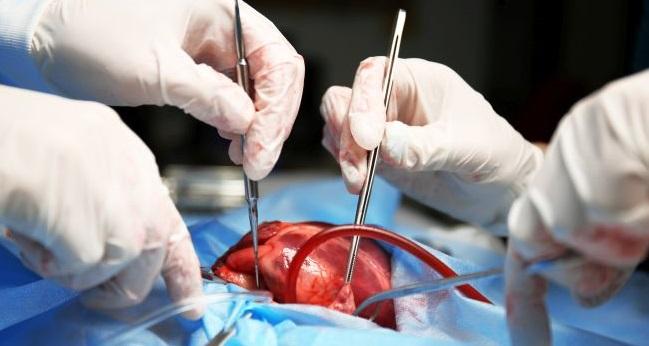 Meta-analysis Supports Surgical LAA Occlusion During Cardiac Surgery, but Flaws Found