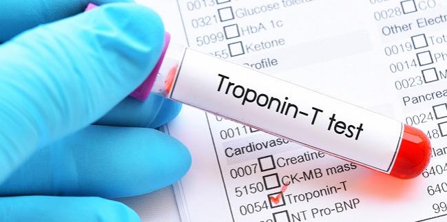 High-Sensitivity Troponin Performs Well Against Traditional Tools for 30-Day MACE Prediction