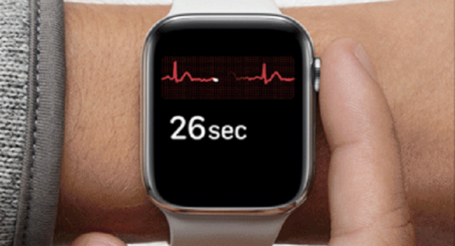 Apple Watch as an ECG? Feasible, May Prove Useful in Emergencies