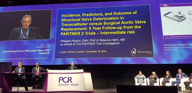 Signal of Impaired Sapien XT Durability in Midterm Follow-up 