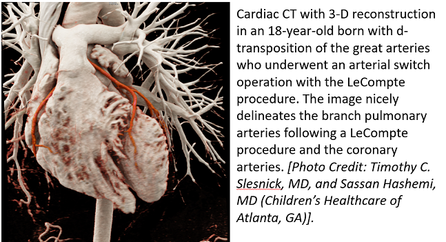 New AUC for Cardiac Imaging Follow-up in Congenital Heart Disease