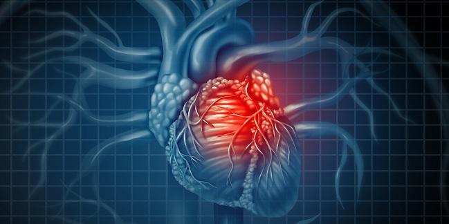 No ‘Obesity Paradox’: BMI and Infarct Size Not Linked in STEMI