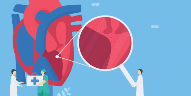 Mavacamten Successful in Obstructive Hypertrophic Cardiomyopathy: EXPLORER-HCM