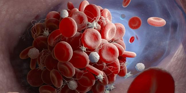 Tirofiban Provides Better Platelet Inhibition Than Cangrelor in STEMI Patients