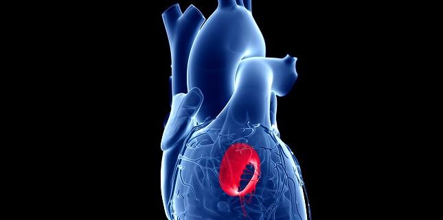 ‘Suboptimal’ Outcomes in Real-world Mitral Valve-in-Valve, Valve-in-Ring: VIVID Registry