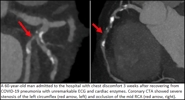 For Cardiac CT, COVID-19 Has Toppled Silos and Paved the Way for Change