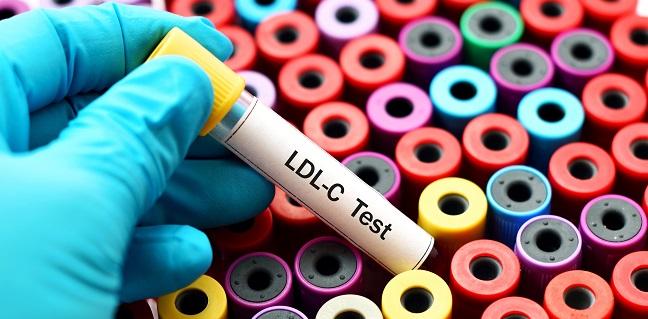 LDL Cholesterol Control Post-PCI Is Low and Linked to Worse Outcomes