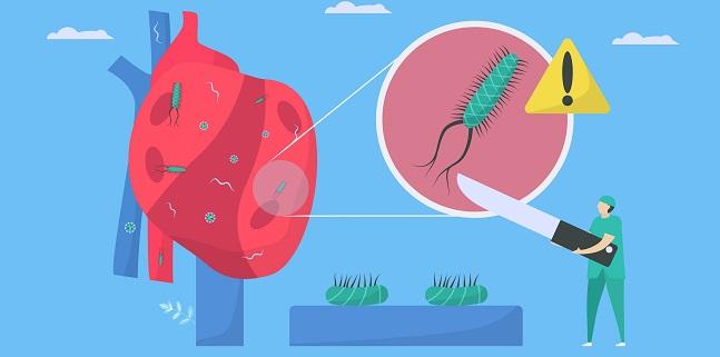 TAVR and Infective Endocarditis—Two Studies Address a Shifting Landscape