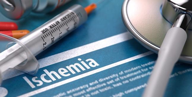 ischemia