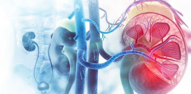 Treating Accessory Arteries May Be Important in Renal Denervation