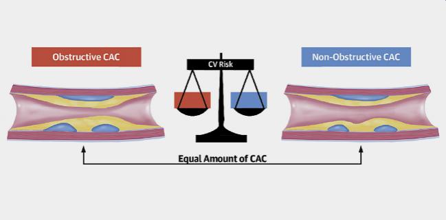 Plaque Burden, Not Coronary Stenosis, Linked to Future Events in Stable CAD