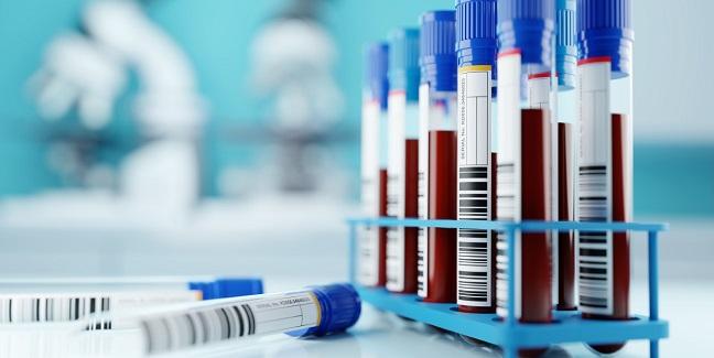 Fall in Hemoglobin Without Overt Bleeding May Be Prognostic in ACS