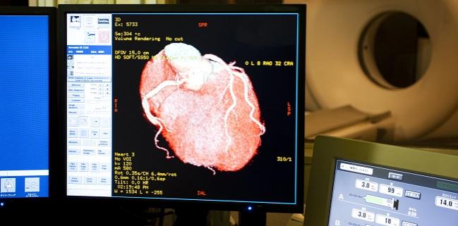 Experts Fear Coronary CT Advice for Patients Misses the Mark   
