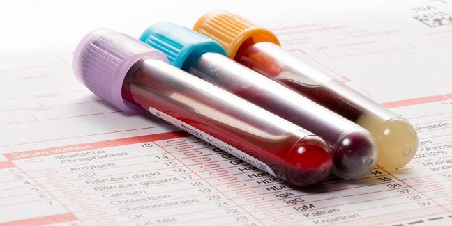 Papers Confirm Rare Thrombocytopenia Link to AstraZeneca Vaccine