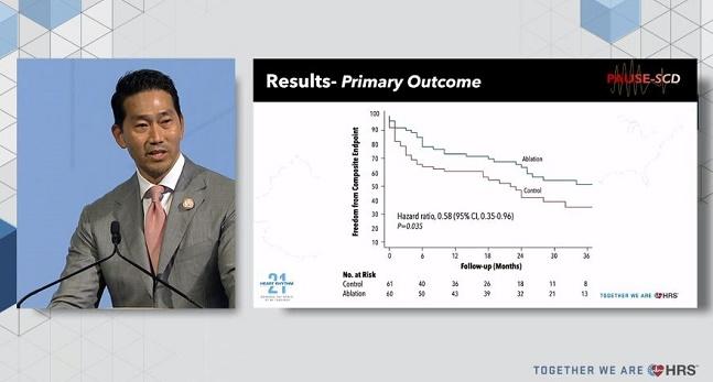 VT, No Matter Its Source, Benefits From Early Catheter Ablation: PAUSE-SCD