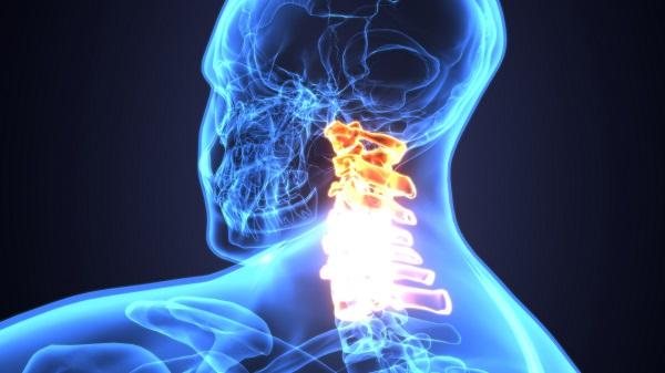 Spinal Cord Stimulation Reduces Post-CABG AF: Pilot Study