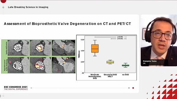 PET Imaging Detects Degeneration After TAVI as Well as Surgical, Native Valves