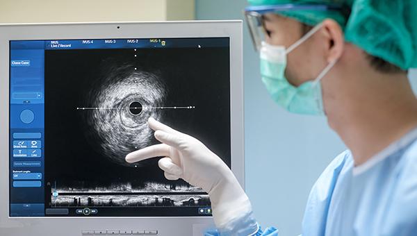 IVUS-Guided PCI Tied to Better Long-term Outcomes After Acute MI