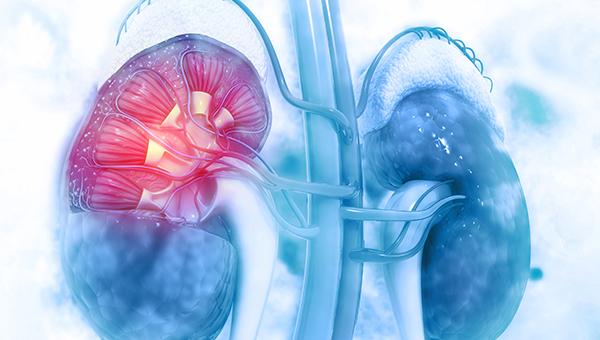 NSTEMI Patients With CKD See Better Outcomes With Invasive Strategy