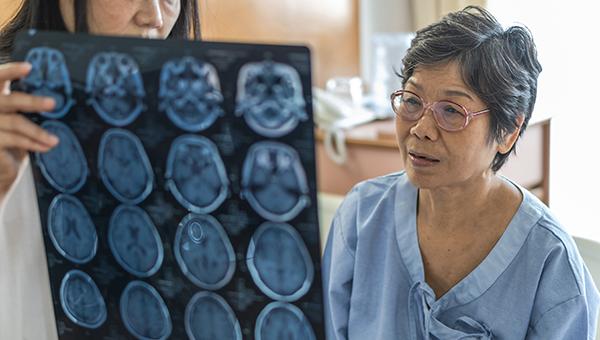 Predictors of AF May Help Guide Care After Stroke of Unknown Cause
