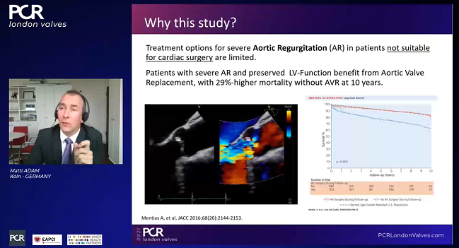 Good Results but Small Numbers With JenaValve Trilogy in Severe AR